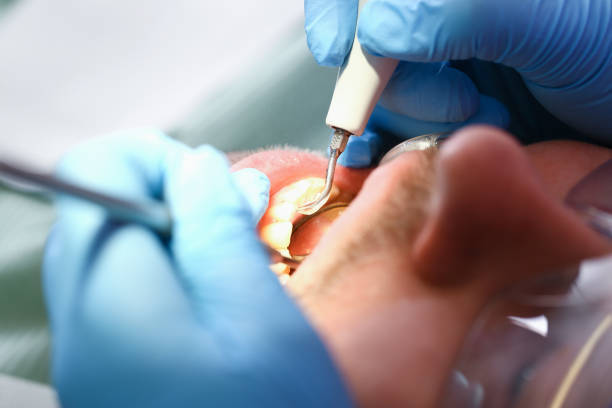 Best Emergency Denture Repair in Baxley, GA