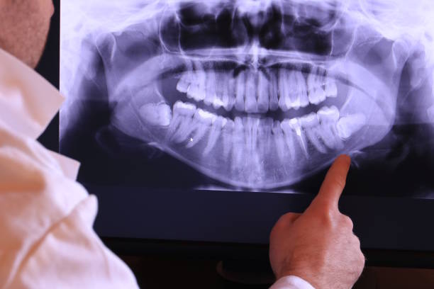Best Emergency Dental Care for Broken or Chipped Teeth in Baxley, GA
